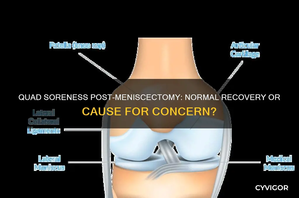 should quad muscles be sore after meniscectomy