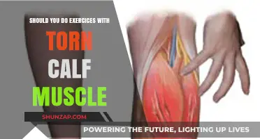 Torn Calf Muscle: To Exercise or Not to Exercise?