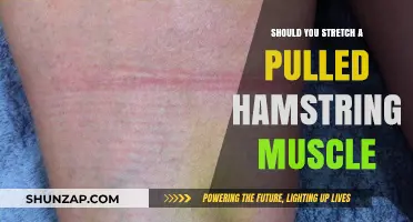 Pulled Hamstring: To Stretch or Not? Expert Advice for Recovery