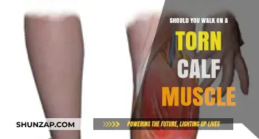 Navigating the Pain: To Walk or Not on a Torn Calf Muscle