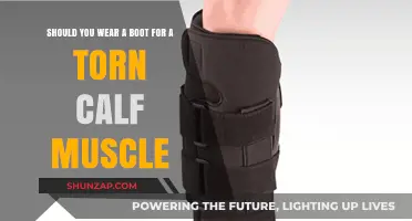 Torn Calf Muscle: To Boot or Not to Boot?