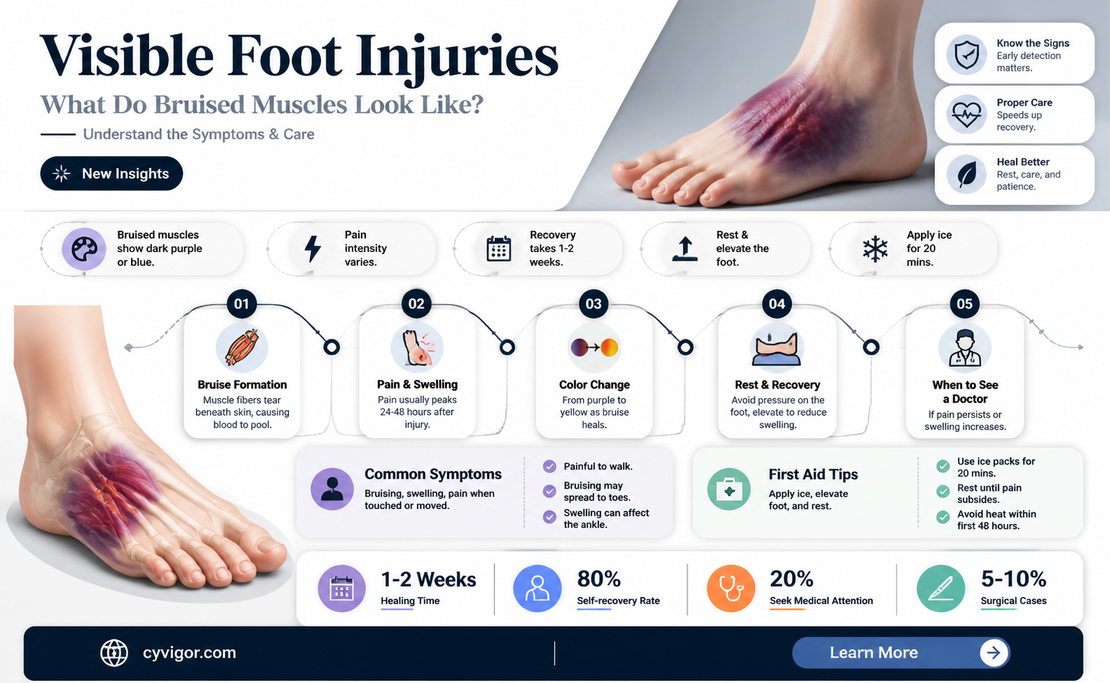 are bruised foot muscles visible
