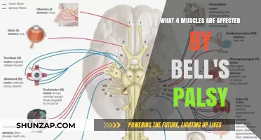 Understanding Bell's Palsy: The Impact on Facial Muscles