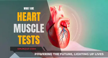 Heart Muscle Tests: What Are They?