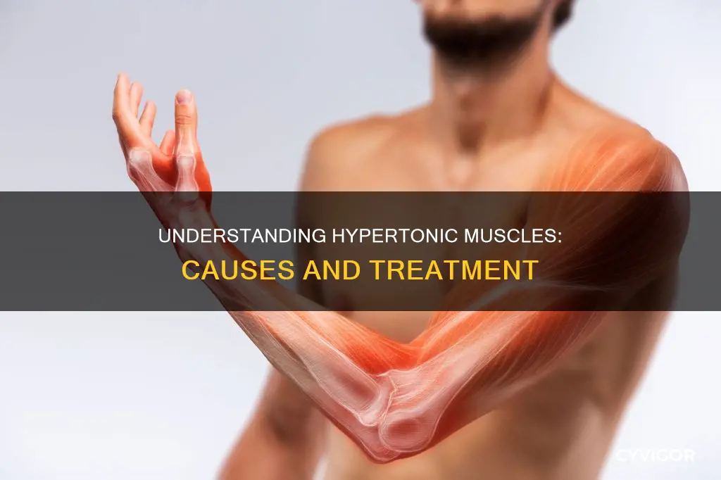 what are hypertonic muscles