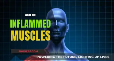 Muscle Inflammation: Causes, Symptoms, and Treatment Options