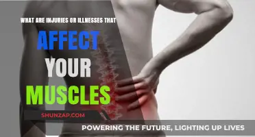 Understanding Musculoskeletal Ailments: A Guide to Common Injuries and Illnesses