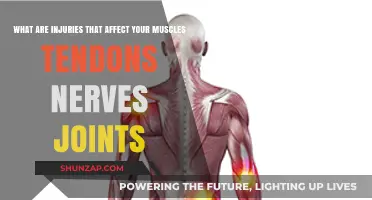 Understanding Musculoskeletal Injuries: A Comprehensive Guide