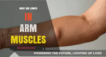 Understanding Lumps in Arm Muscles: Causes, Symptoms, and Treatment Options