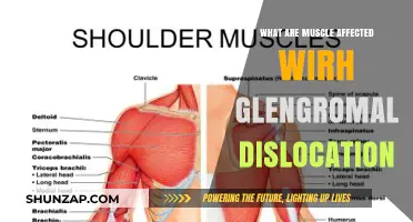 Understanding Glengromal Dislocation: Impact on Surrounding Muscles