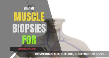 Muscle Biopsy Benefits: Understanding Muscle Disorders