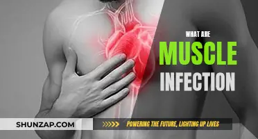 Understanding Muscle Infections: Causes, Symptoms, and Treatments
