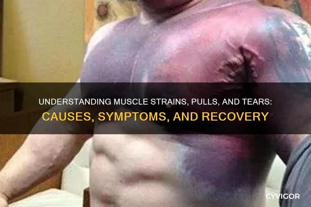 what are muscle strains pulls and tears