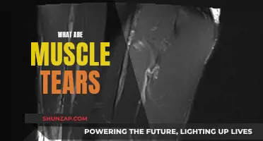 Understanding Muscle Tears: Causes, Treatment, and Prevention