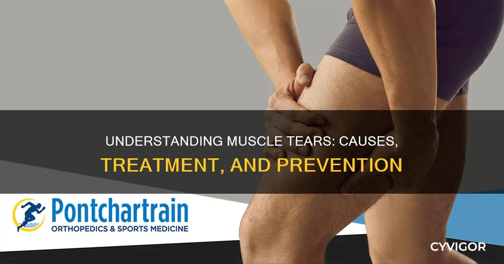 what are muscle tears