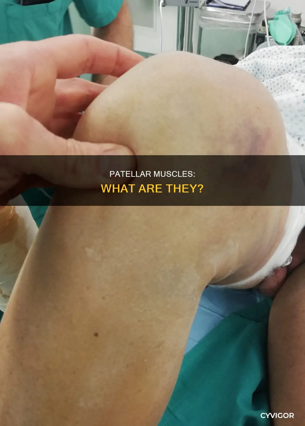 what are patellar muscles