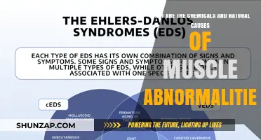 Muscle Abnormalities: Natural and Chemical Causes