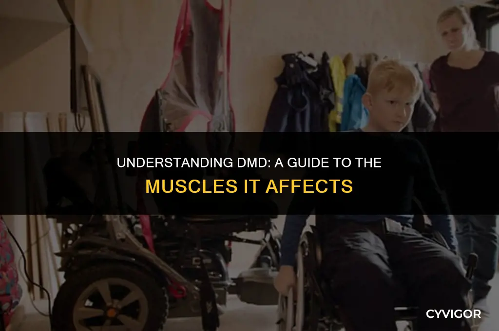 what are the muscles affected by dmd