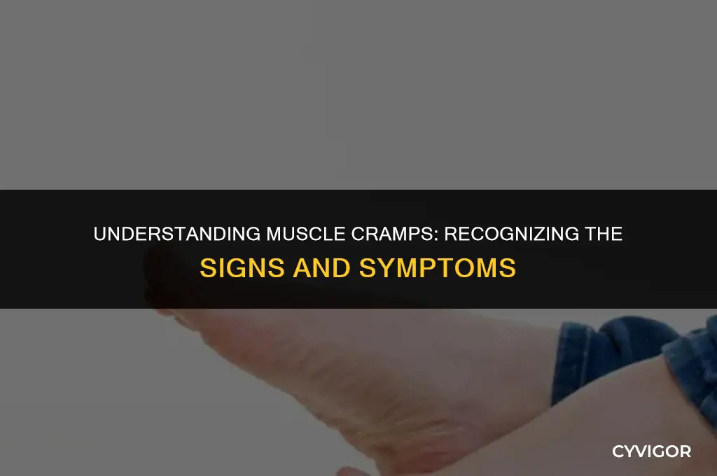what are the signs and symptoms of muscle cramps