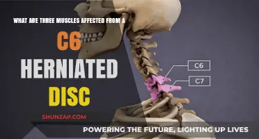 Cervical Spine Health: Muscles Impacted by a C6 Herniated Disc