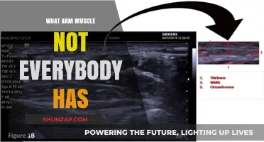 The Hidden Arm Muscle: Unveiling the Palmaris Longus Mystery
