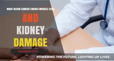 Blood Cancer: Muscle Loss, Kidney Damage, and Treatment