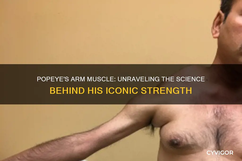 what caisrds popeye arm muscle