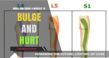 Muscle Bulging and Pain: What's the Cause?