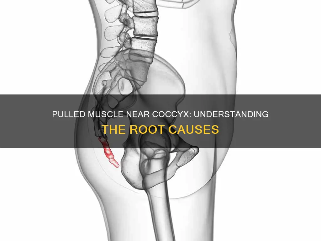 what can cause a pulled muscle near coccyx