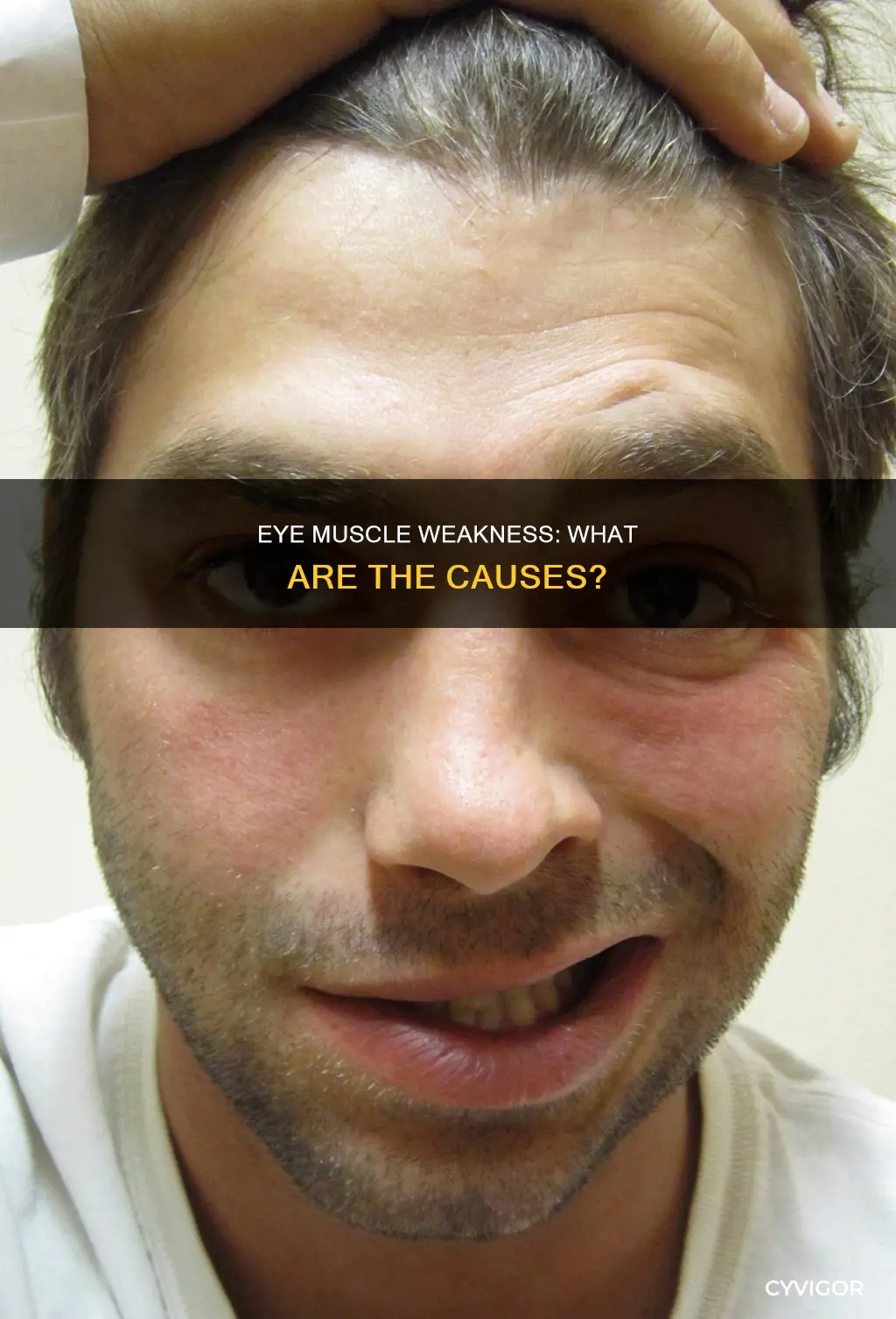 what can cause eye muscle weakness