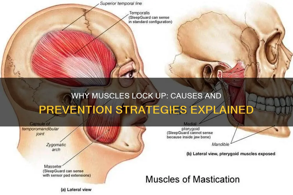 what can cause muscles to lock up