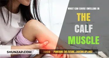 Calf Muscle Swelling: Causes, Risks, and When to Seek Help