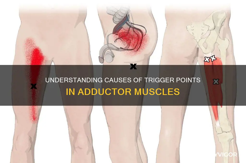 what can cause trigger points in the adductor muscles