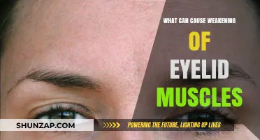 Understanding Eyelid Muscle Weakness: Causes and Contributing Factors Explained