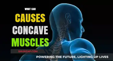Understanding Concave Muscles: Causes, Prevention, and Effective Treatment Options