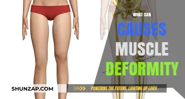 Understanding Muscle Deformity: Causes, Symptoms, and Prevention Strategies