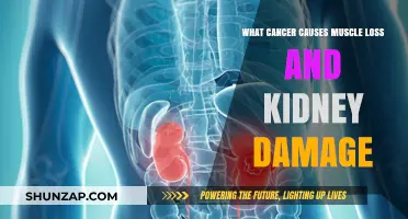 Cancer-Induced Muscle Wasting and Kidney Damage: Understanding the Link