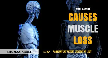 Understanding Cancer's Impact: How Tumors Lead to Muscle Wasting