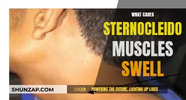 Sternocleidomastoid Swelling: Understanding the Root Cause