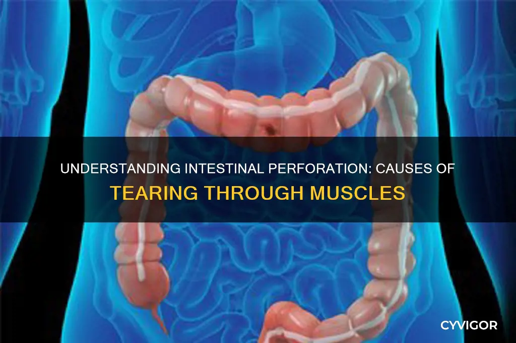 what cause intestine to tear through muscles