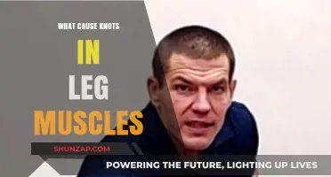 Understanding Leg Muscle Knots: Causes, Prevention, and Relief Strategies