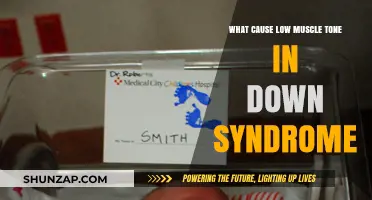 Understanding Low Muscle Tone in Down Syndrome: Causes and Insights