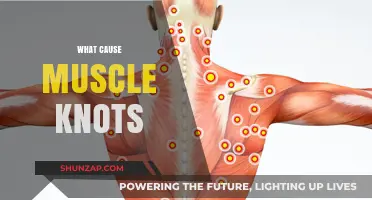 Understanding Muscle Knots: Causes, Triggers, and Prevention Strategies