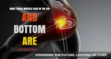 Understanding Hip and Glute Muscle Loss: Causes and Prevention Tips
