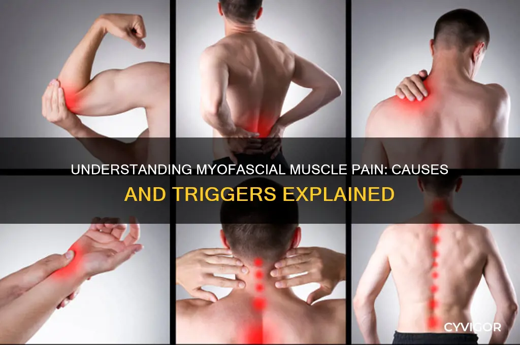 what cause myosfascial muscle pain