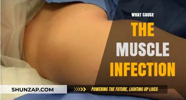 Understanding Muscle Infections: Causes, Symptoms, and Prevention Strategies