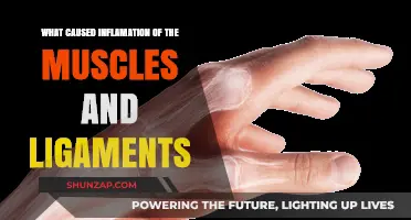 Understanding Muscle and Ligament Inflammation: Causes and Triggers Explained