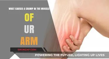 Understanding Arm Muscle Cramps: Causes and Prevention Tips