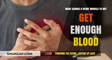 Understanding Ischemia: Why Your Heart Muscle Isn’t Getting Enough Blood