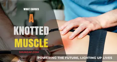 Understanding Knotted Muscles: Causes, Prevention, and Effective Relief Strategies